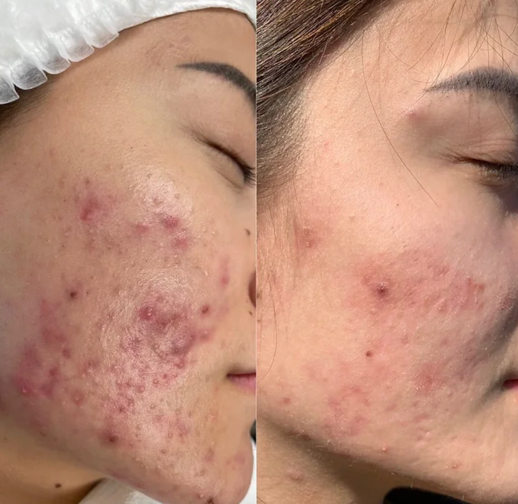 Dr. Melaxin (2 PCS)