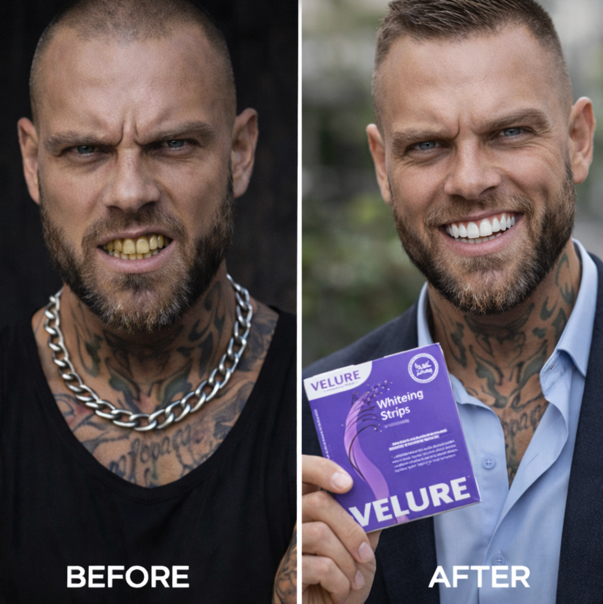 Velure nHAP-Pro Whitening Strips - 14 Strips