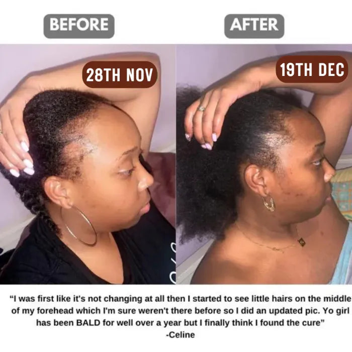 100% Raw Batana Oil