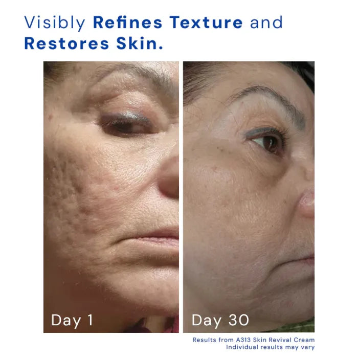 PureA313 - Vitamin A & Retinol Cream