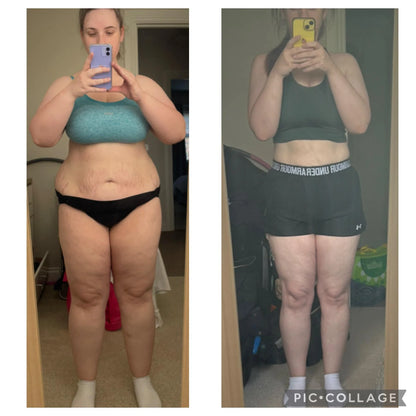 Velure™ - Full-Body Sculpting Fascia Ring