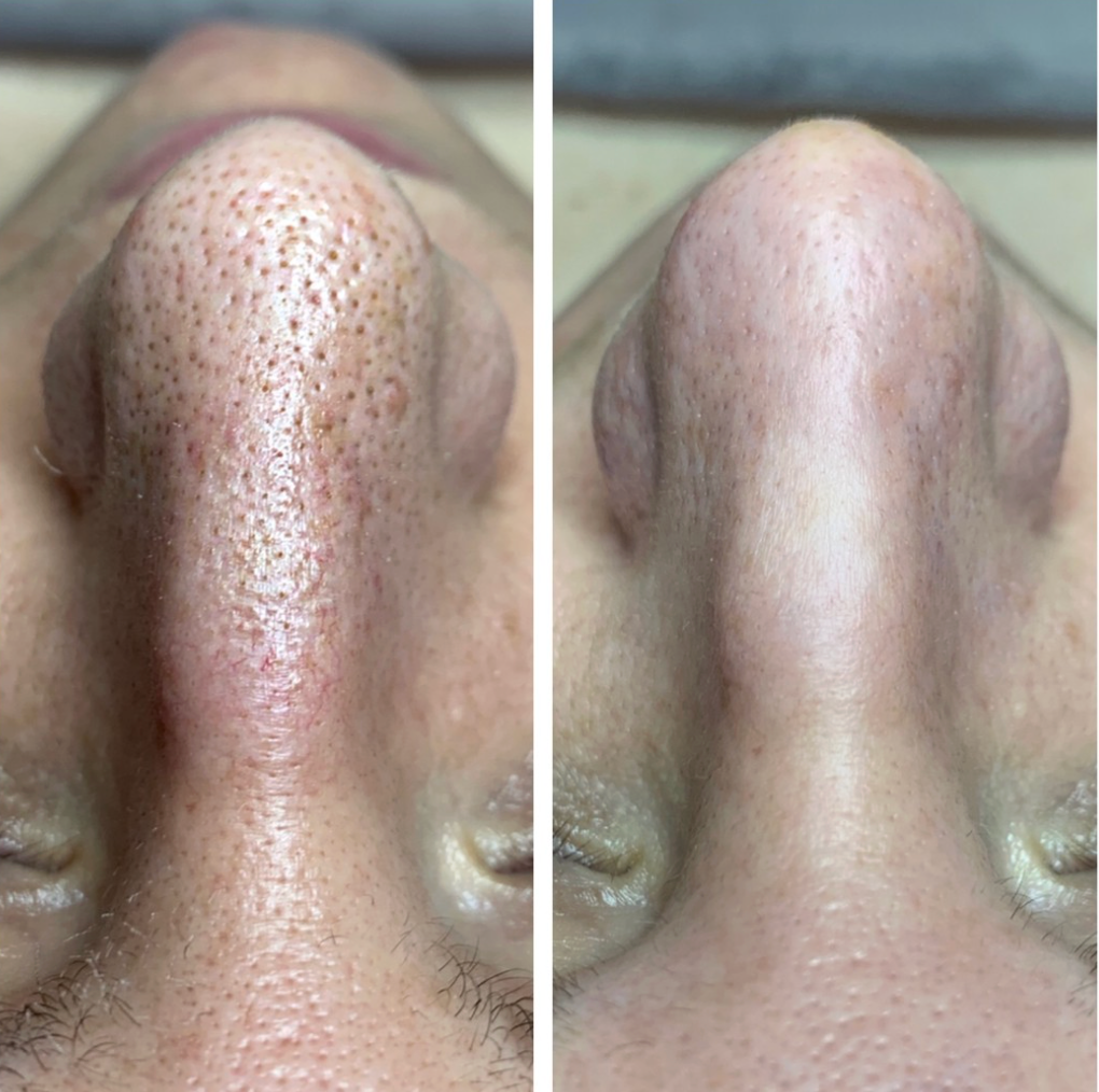 Dr. Melaxin (2 PCS)