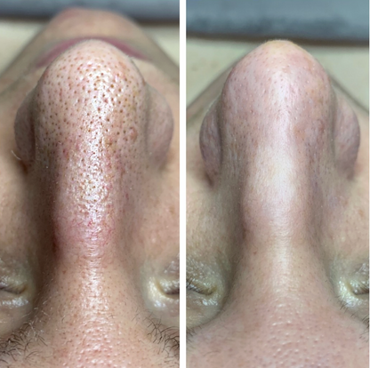 Dr. Melaxin (2 PCS)