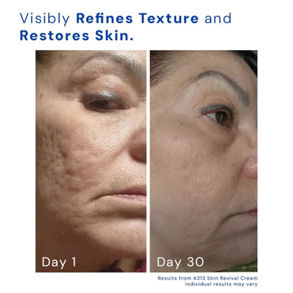 PureA313 - Vitamin A & Retinol Cream